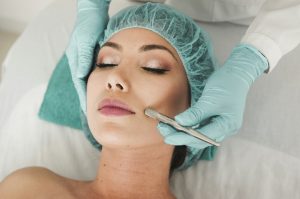 Consultation médicale avant une épilation laser du visage